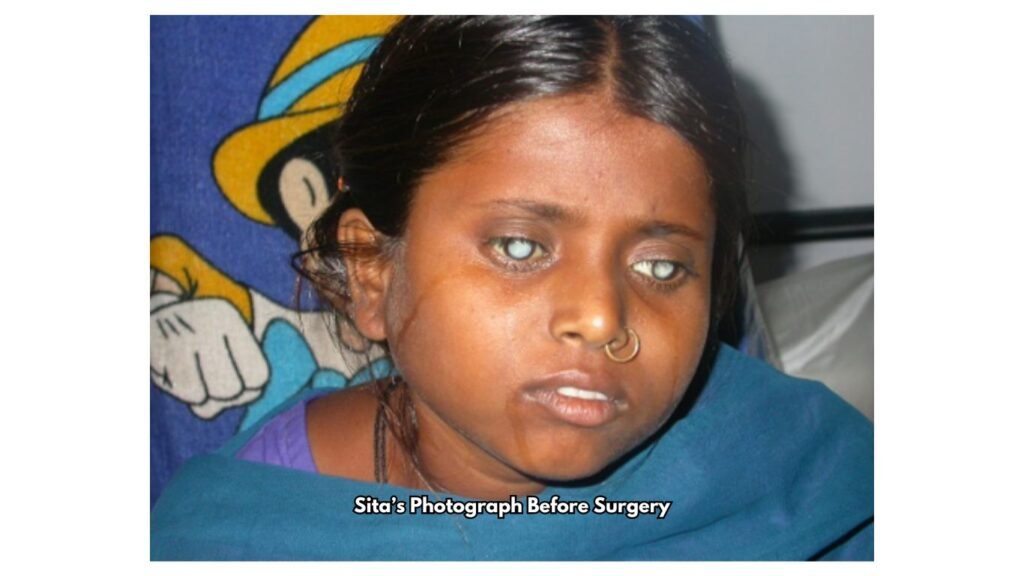 Sita before Surgery